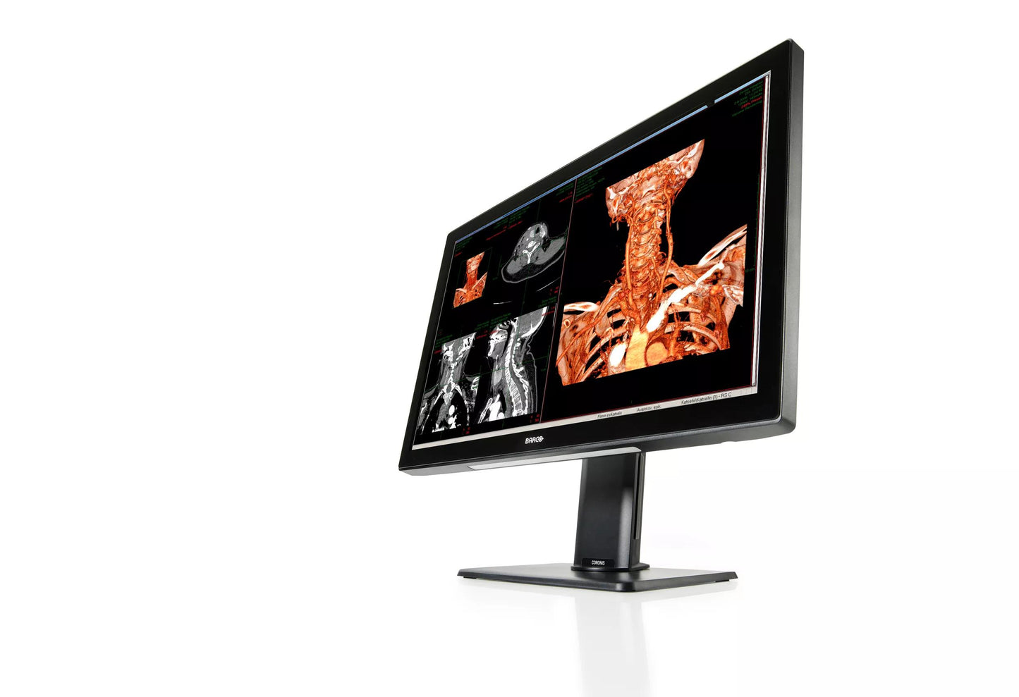 Barco MDCC?4430 computer monitor 30.4" 2560 x 1600 pixels LED Black