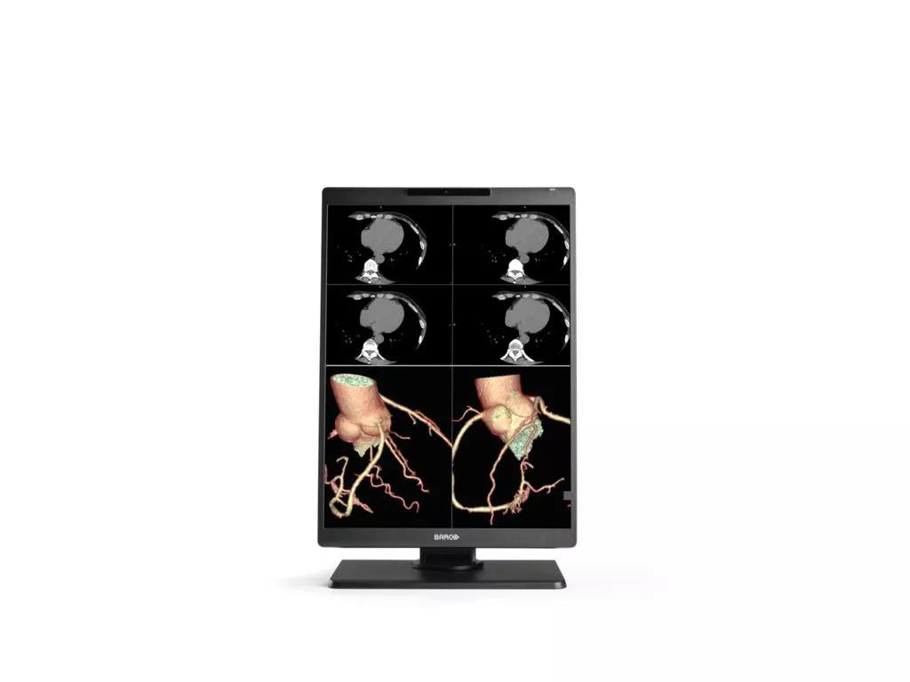 Barco MDNC?2521 computer monitor 21.3" 1600 x 1200 pixels LCD Black