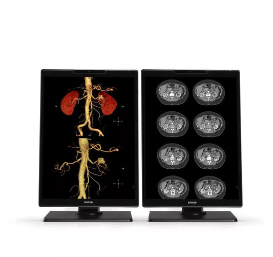 Barco MDNC?3521 computer monitor 21.3" 2048 x 1536 pixels LCD Black