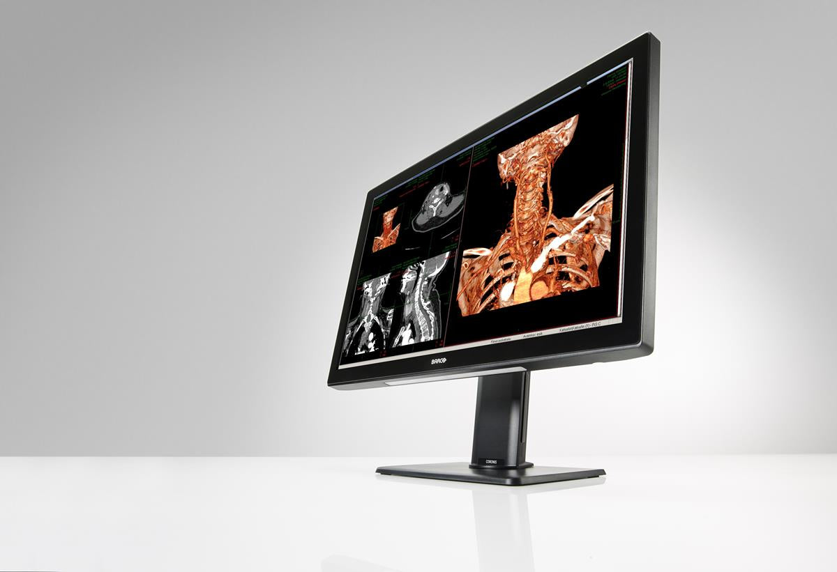Barco MDCC-6530 computer monitor 30.4" 3280 x 2048 pixels 4K Ultra HD Black, White