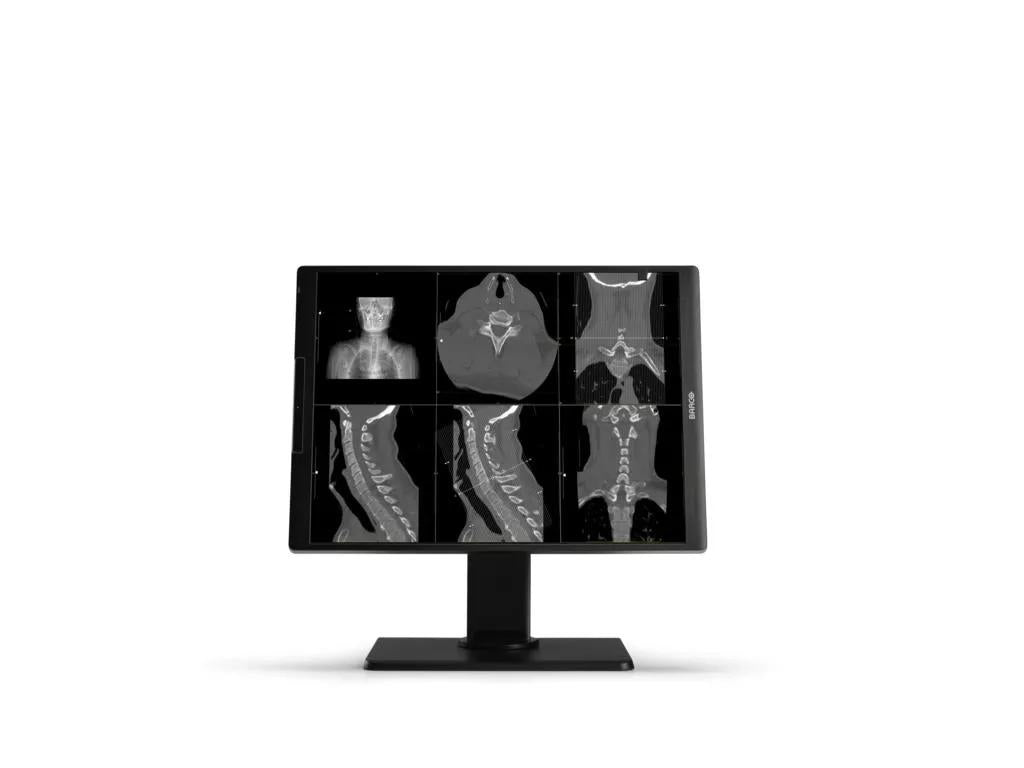 Barco MDNC?2521 computer monitor 21.3" 1600 x 1200 pixels LCD Black